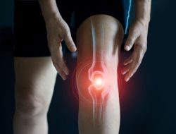 Mengenal Osteoarthritis Lutut: Penyebab dan Kapan Harus Operasi