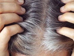 Penelitian: Rambut Putih Jadi Perlindungan Alami Terhadap Kanker