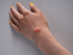 Mengapa Penderita Diabetes Lebih Rentan Terkena Infeksi?