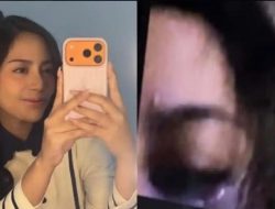 Mata kiri Rachel Vennya jadi perhatian, foto lebam viral di media sosial